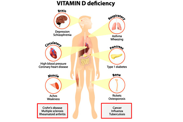 Vitamin D reduced bone fractures