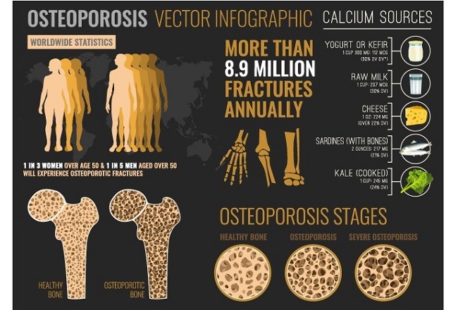 biosil for fractures and osteoporosis