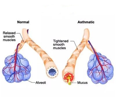 Asthma Products