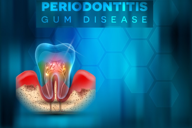 coq10 improves periodontitis and gum health