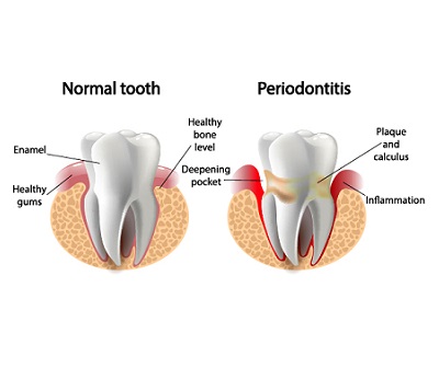 Dental Health Image