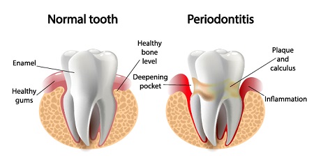 dental health category header